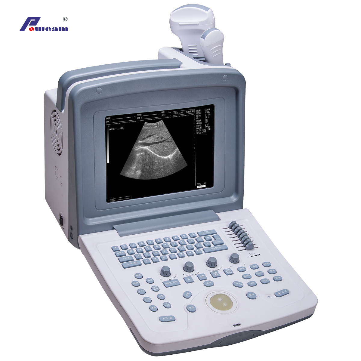 Escáner de ultrasonido portátil médico