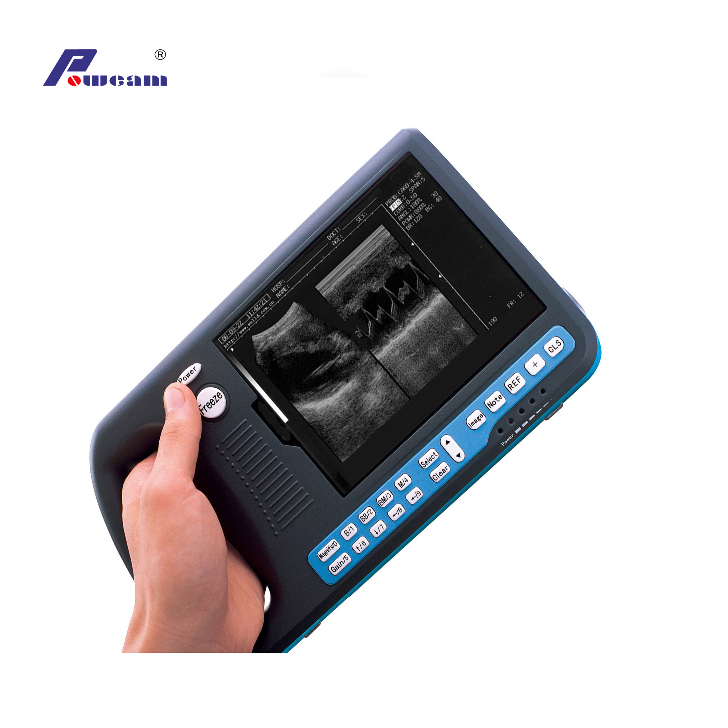Escáner de ultrasonido Digital PalmTop Hosipital