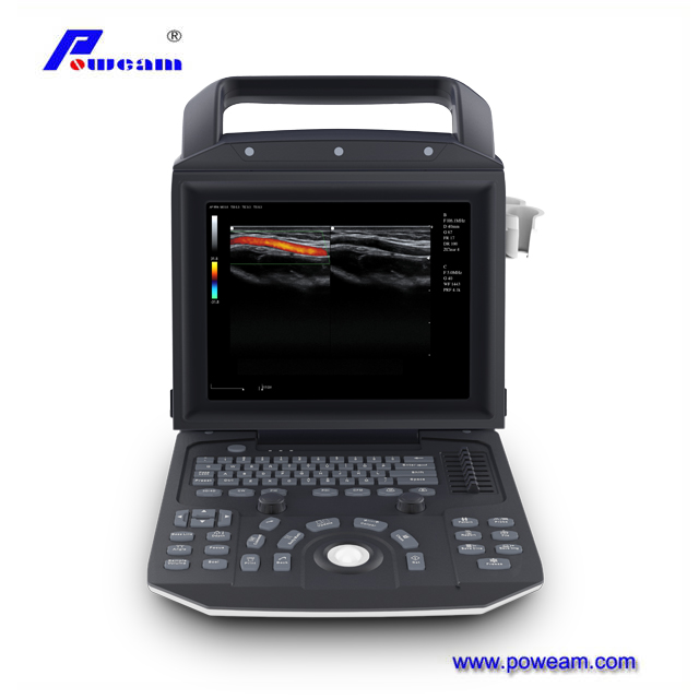 Escáner de ultrasonido doppler de color portátil 2D/3D/4D