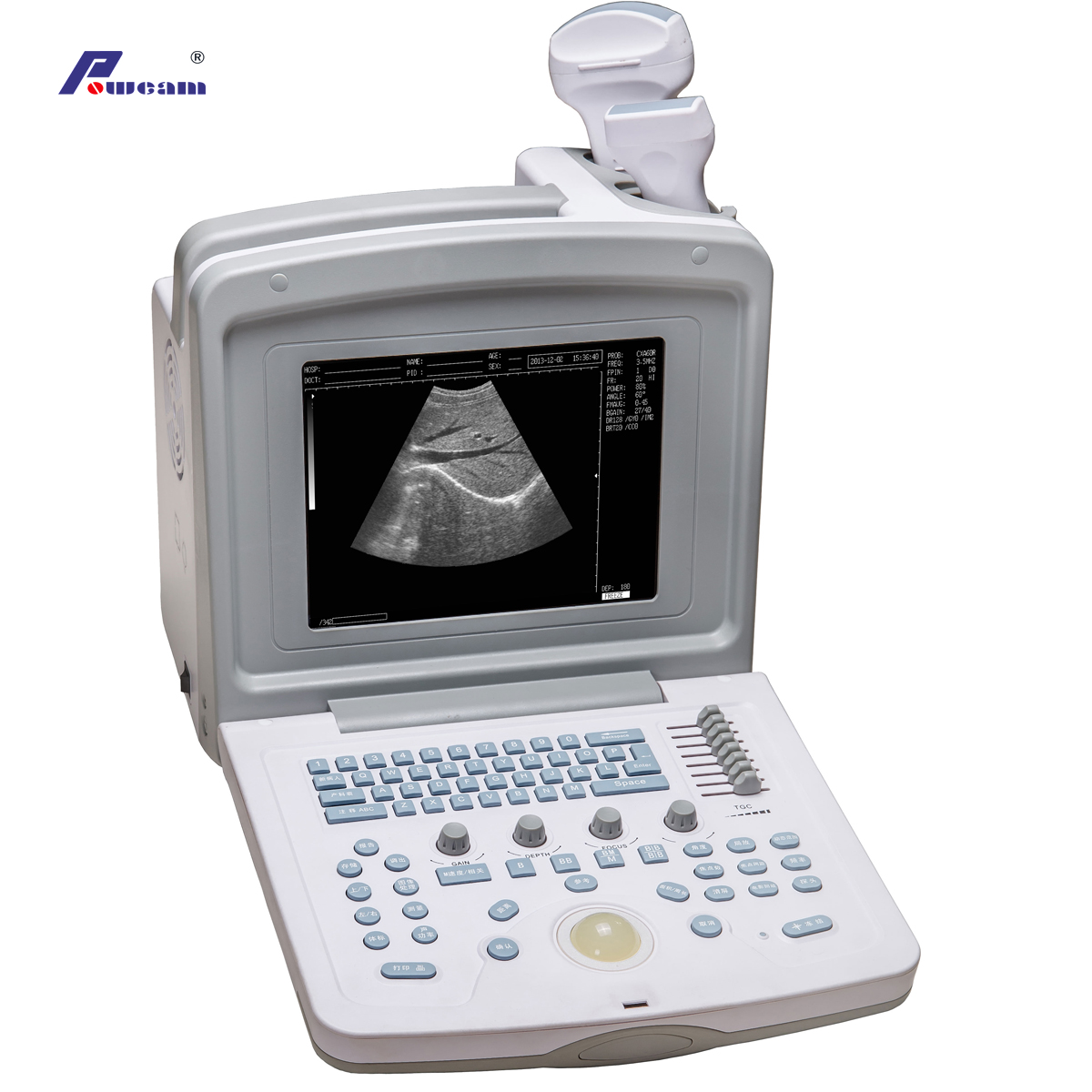 Escáner de ultrasonido portátil médico