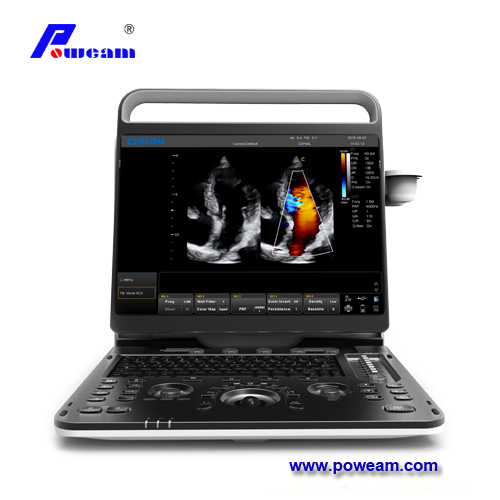 Chison EBIT60 Color portátil Doppler ultrasonido escáner para cardíaco 