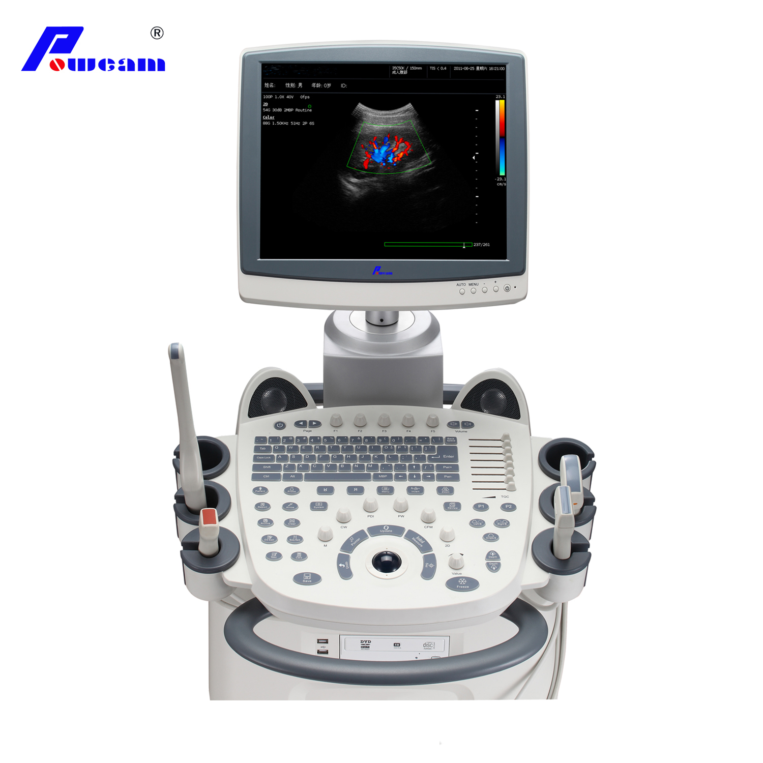 Escáner de ultrasonido doppler de color diagnóstico ultrasónico (D70)