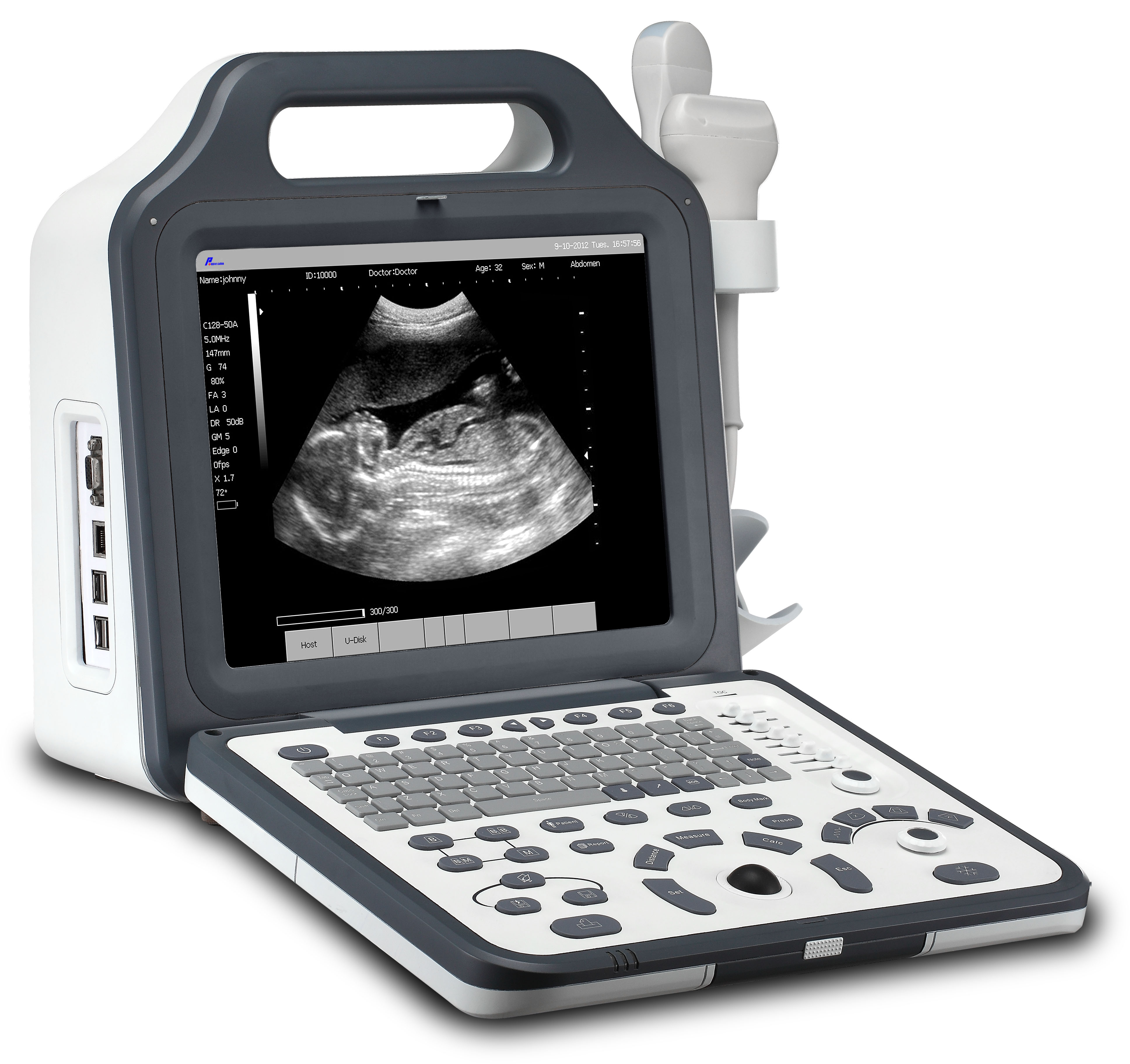 Hospital aprobado por CE 12.1 "LCD Ultrasonido digital para computadora portátil (WHYC60P)
